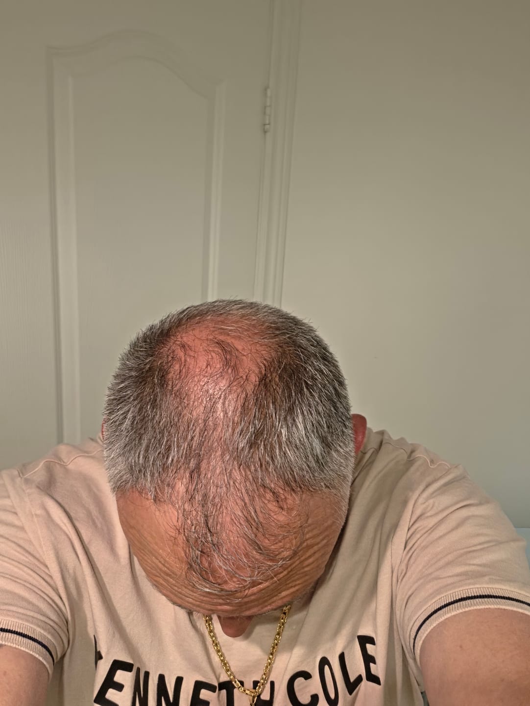 Customer photo review of SHAMPOING NATUREL AU ROMARIN ET À LA KÉRATINE — POUR DES CHEVEUX PLUS ÉPAIS ET PLUS VOLUMINEUX