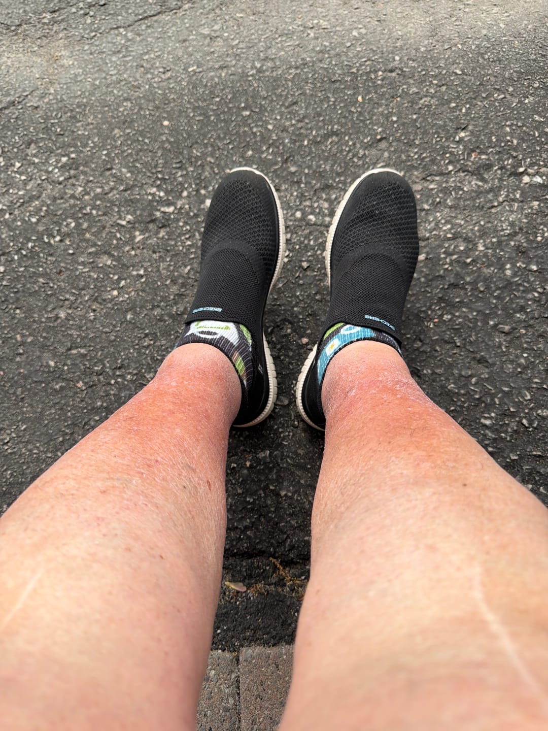 Customer photo review of Butterfly Ankle Compression Socks