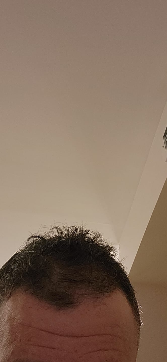 Customer photo review of SHAMPOING NATUREL AU ROMARIN ET À LA KÉRATINE — POUR DES CHEVEUX PLUS ÉPAIS ET PLUS VOLUMINEUX