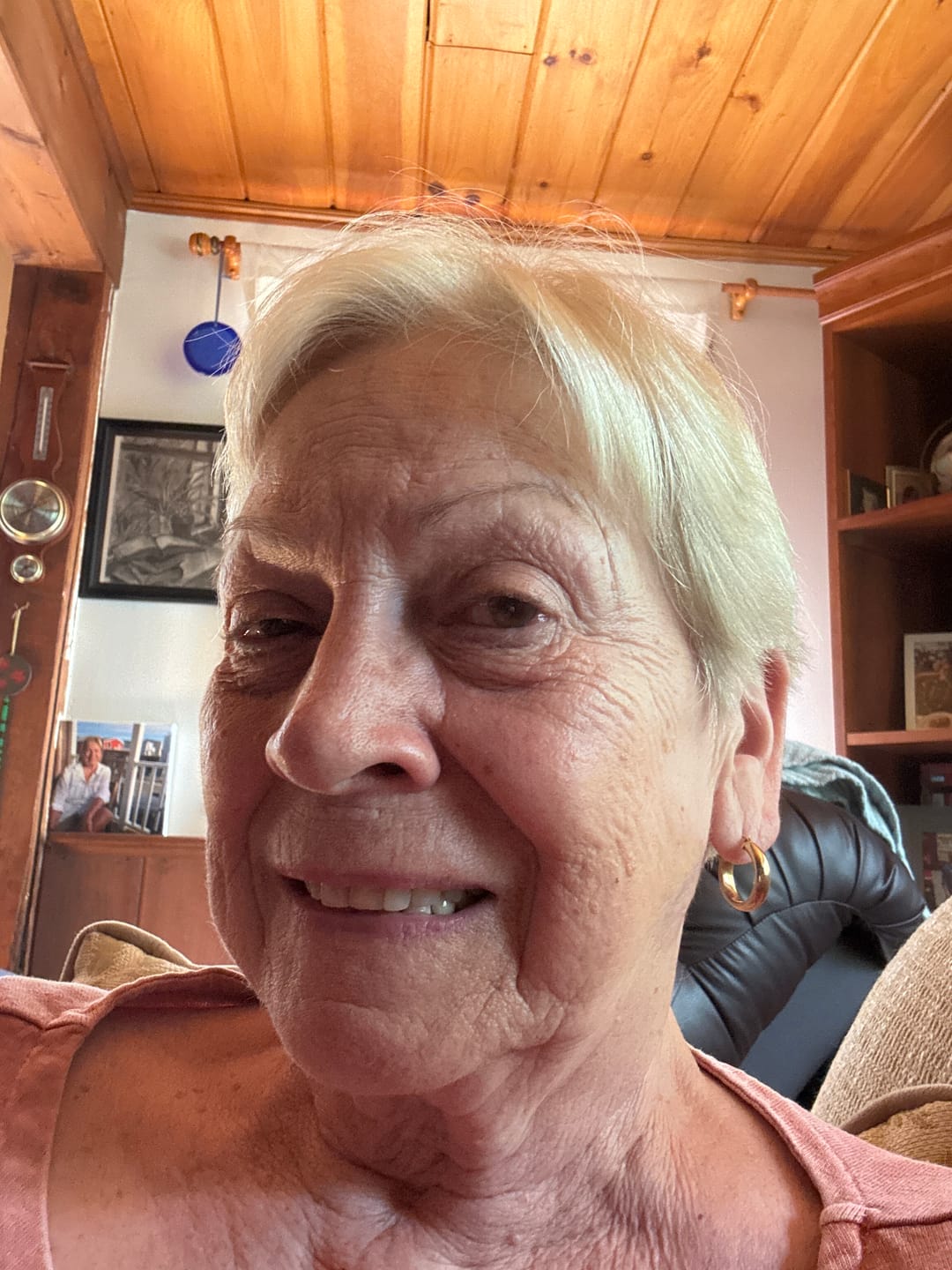 Customer photo review of Glov Anti-Aging Serum (5ml)