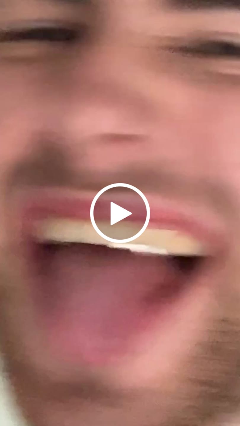Customer video review of Grillz Case
