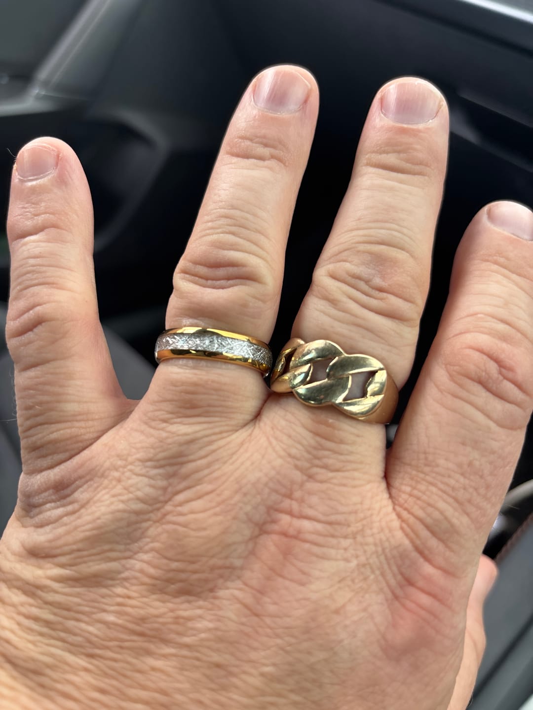 Customer photo review of The Golden Steel Wonder Ring Set