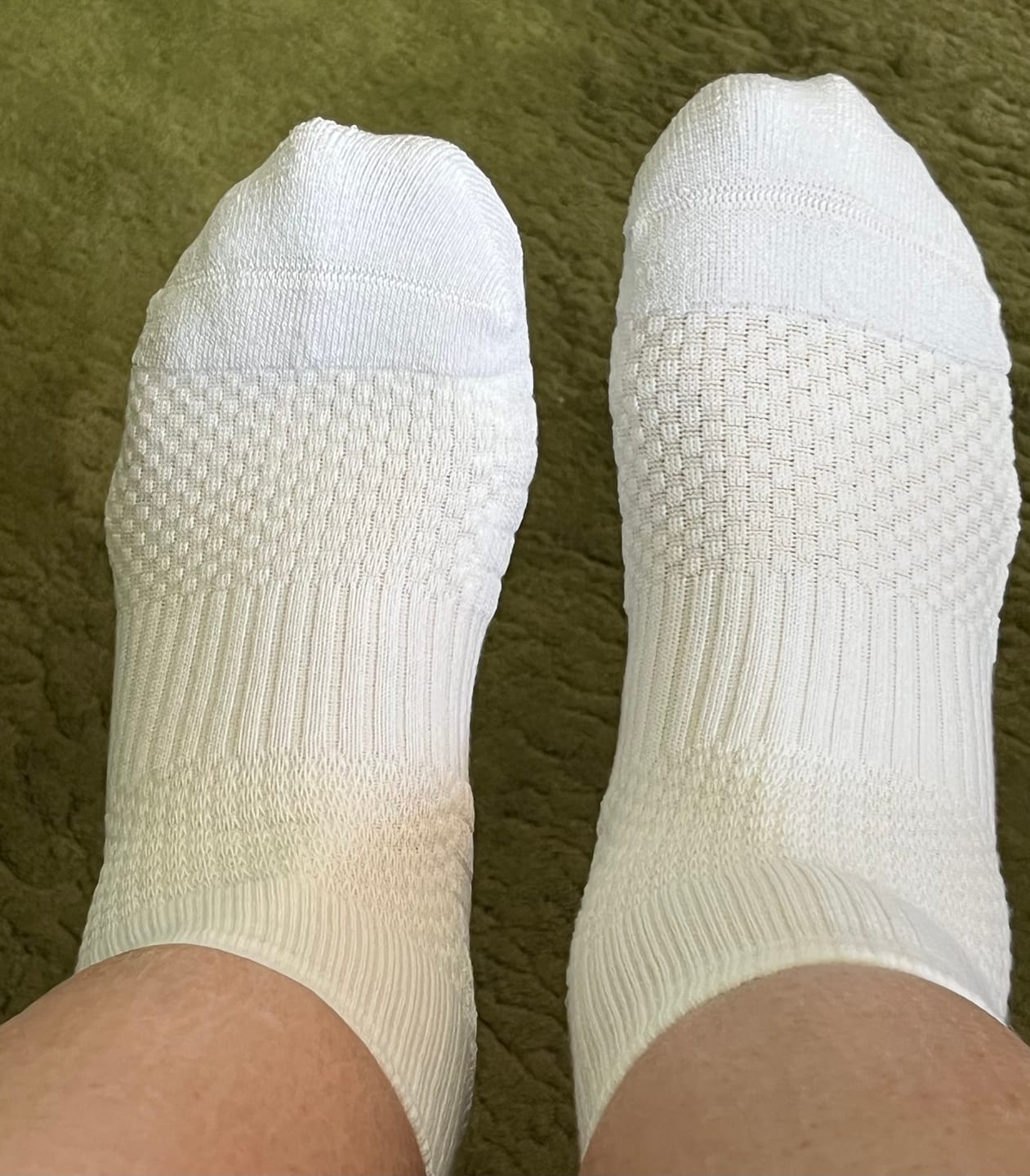 Customer photo review of White Ankle Compression Socks 5-Pack Bundle