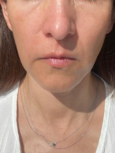 Customer photo review of Salmon PDRN Pink Collagen Jelly Gel Mask