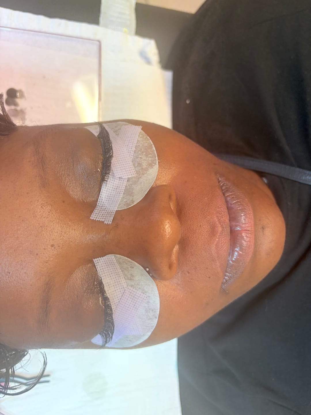 Customer photo review of 50PC Under Eye Gel Pads