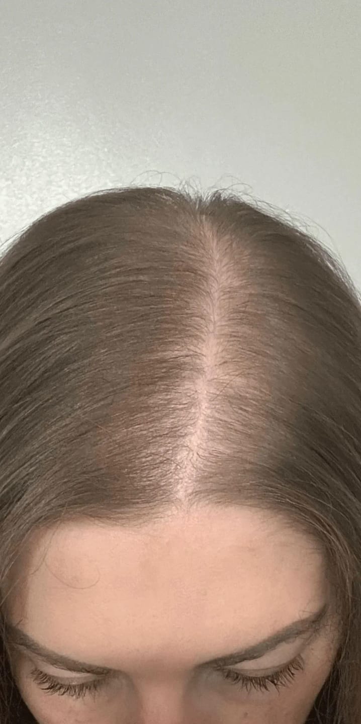 Customer photo review of Zephario™ Ferro Cell Restore