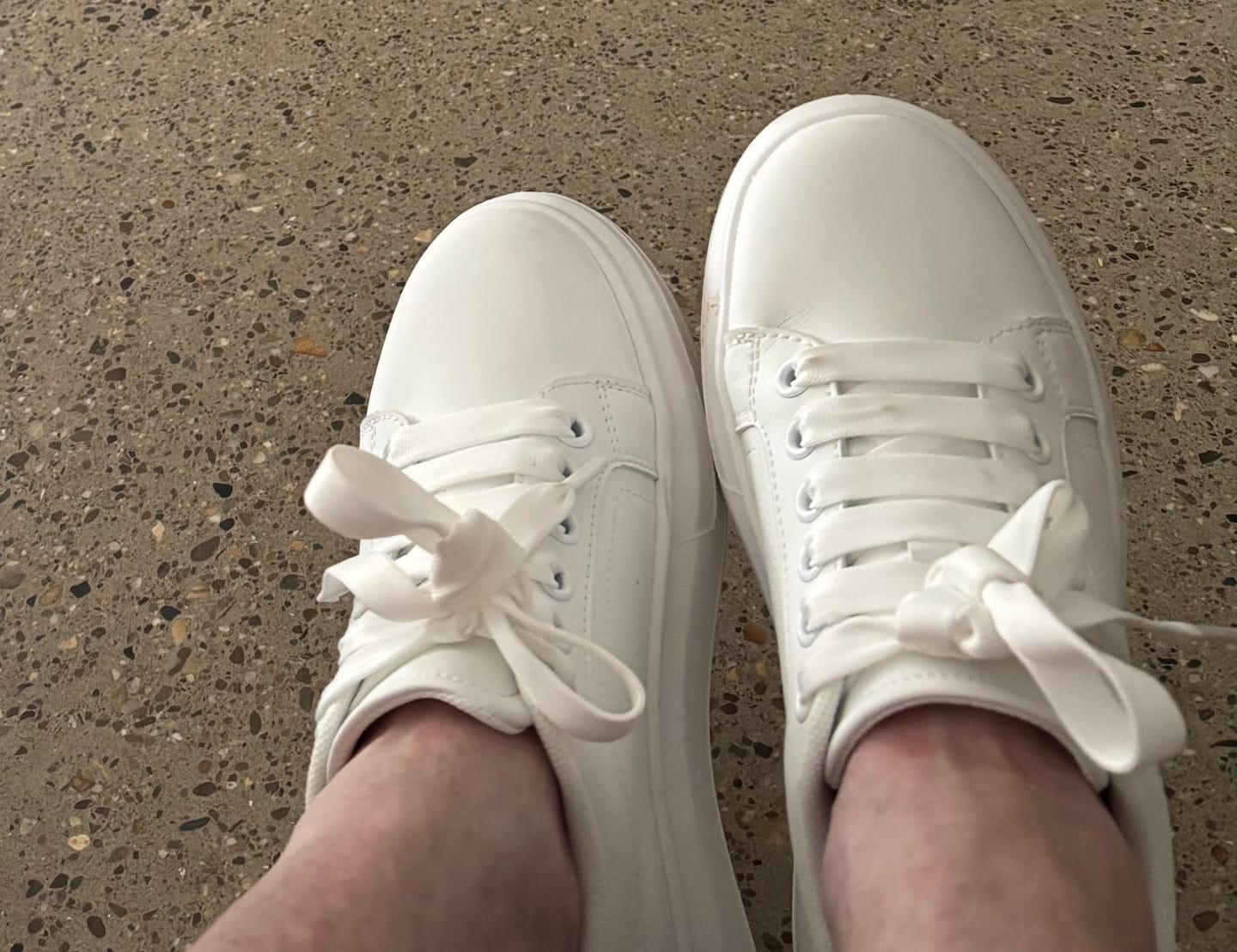 Customer photo review of Aven - 8cm (3")