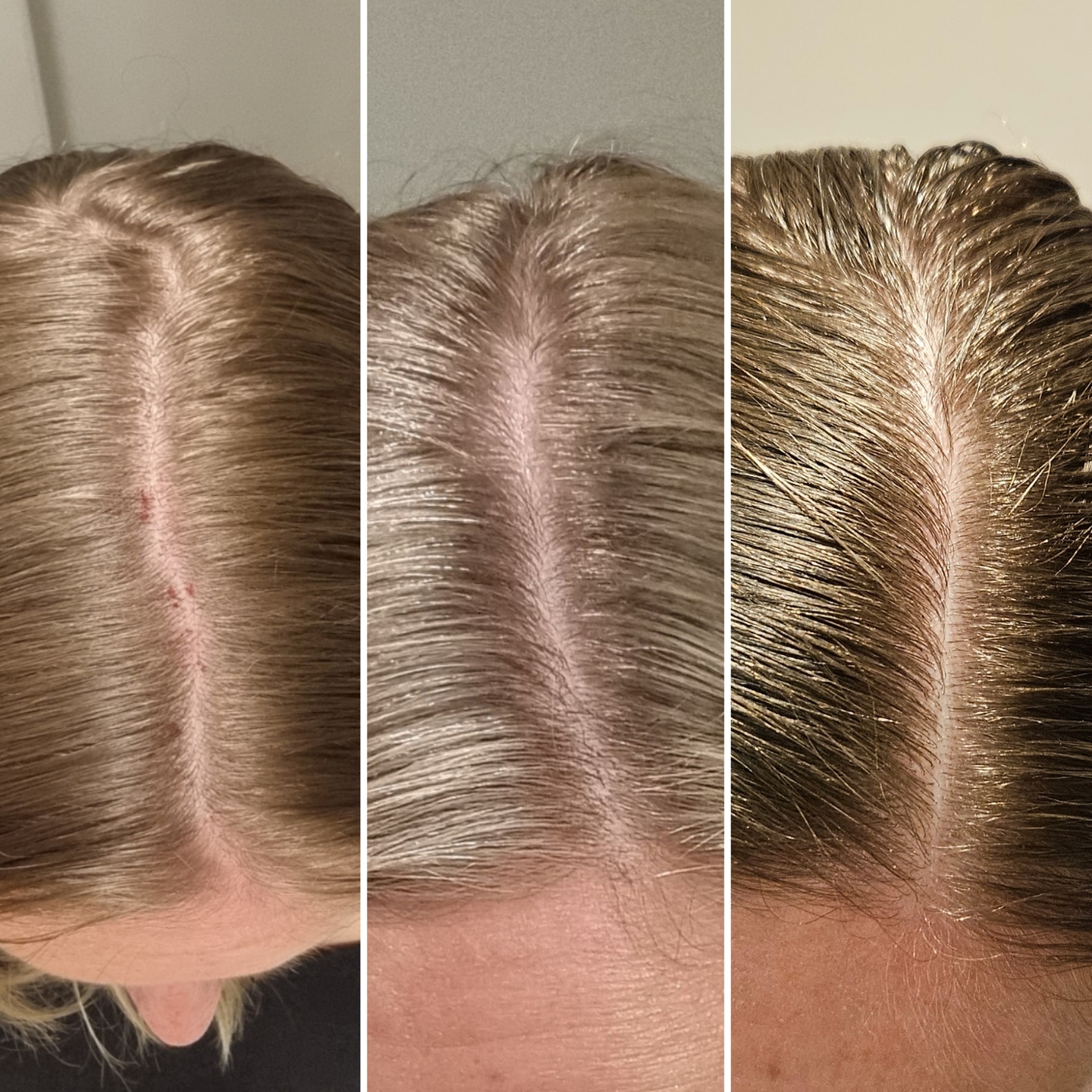 Real Growplex customer scalp