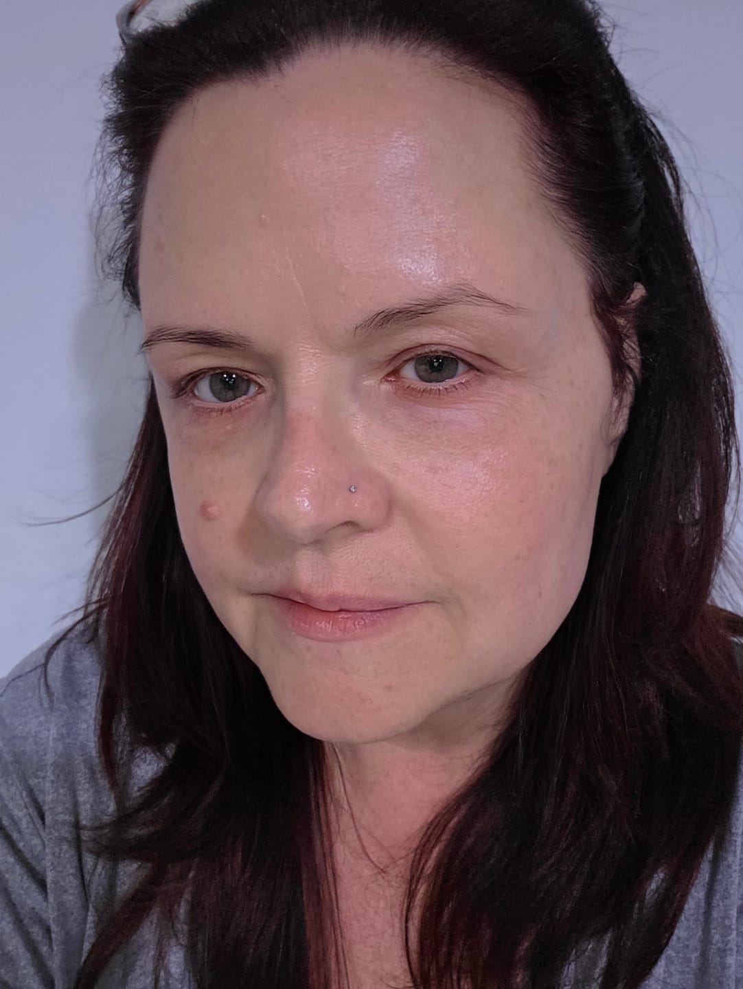 Customer photo review of 3 Month Supply - Deep Collagen Cream