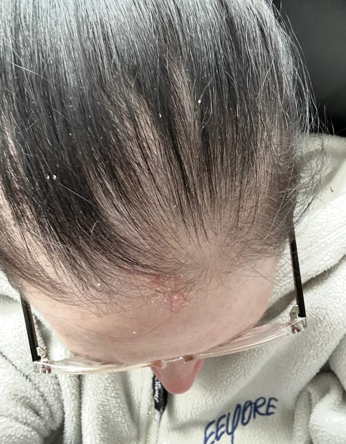 Customer photo review of Zephario™ Ferro Cell Restore