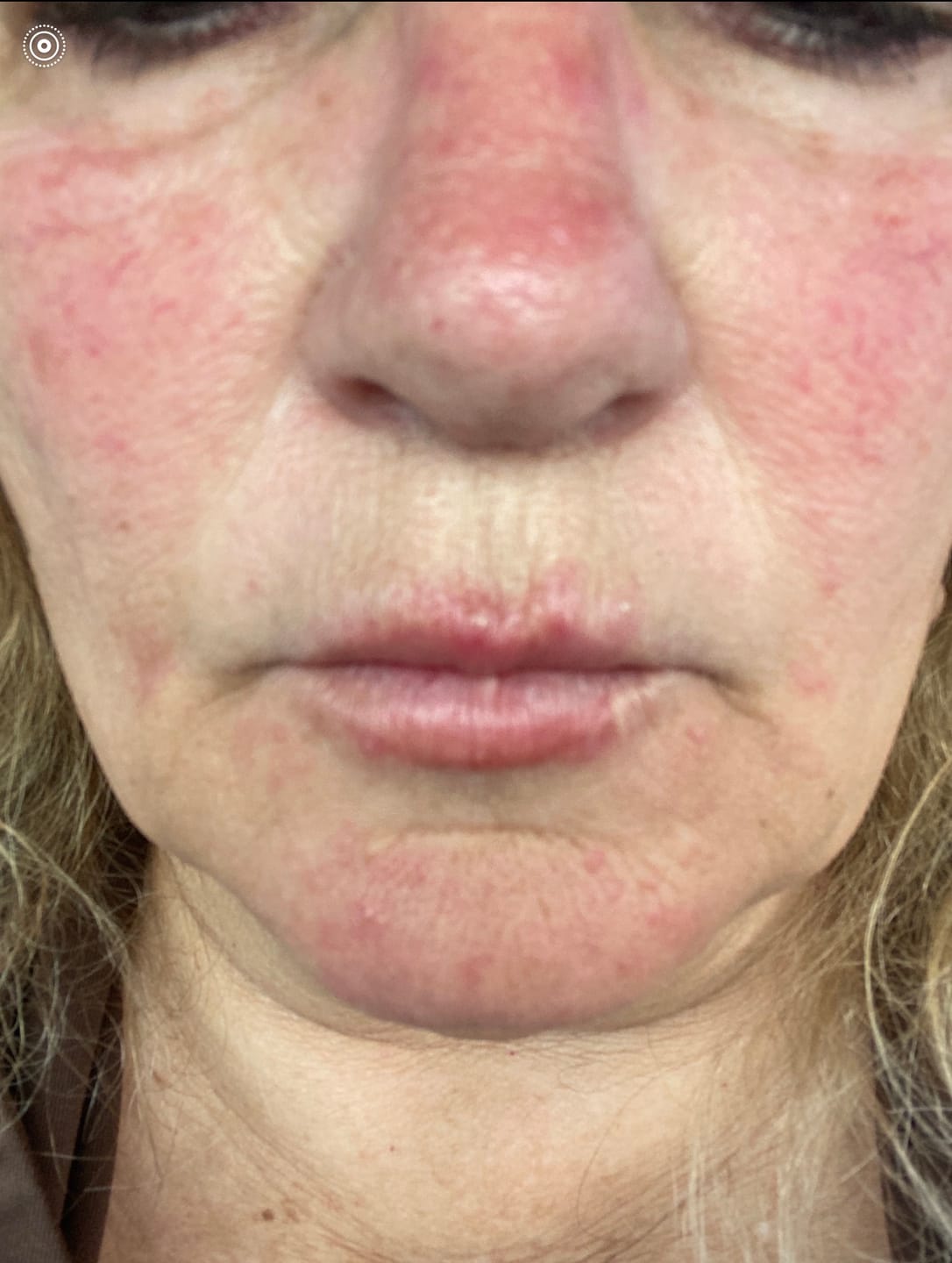Customer photo review of Emepelle Night Cream