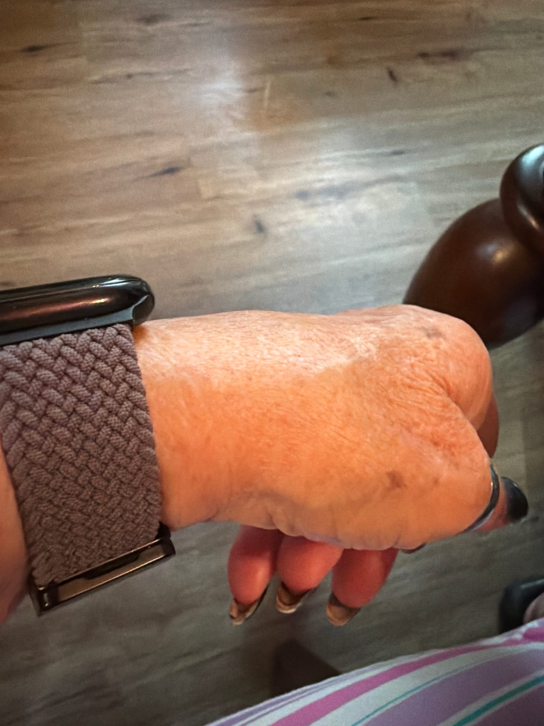 Customer photo review of FlexiFit™ Braided Magnetic Band - BUY 1 GET 1 FREE!