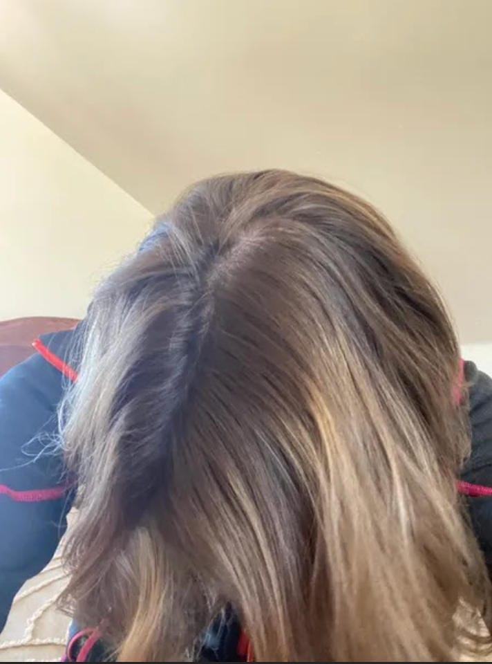 Customer photo review of Spray de Aceite para el Crecimiento del Cabello
