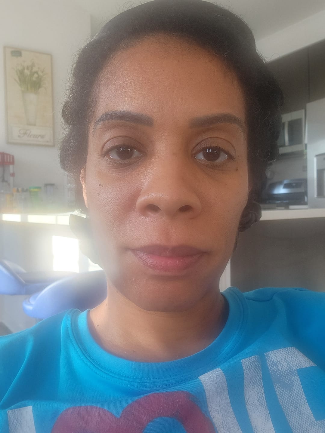 Customer photo review of The Micro Infusion System™