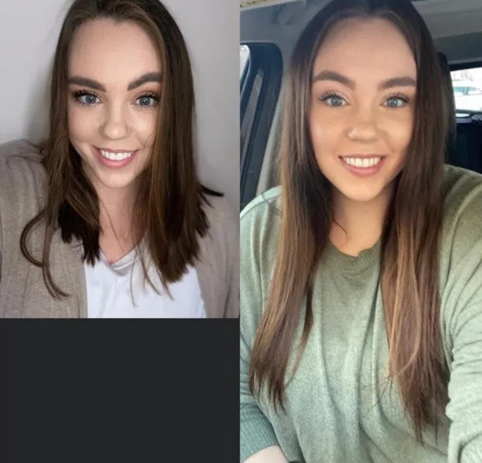 Customer photo review of Spray de Aceite para el Crecimiento del Cabello