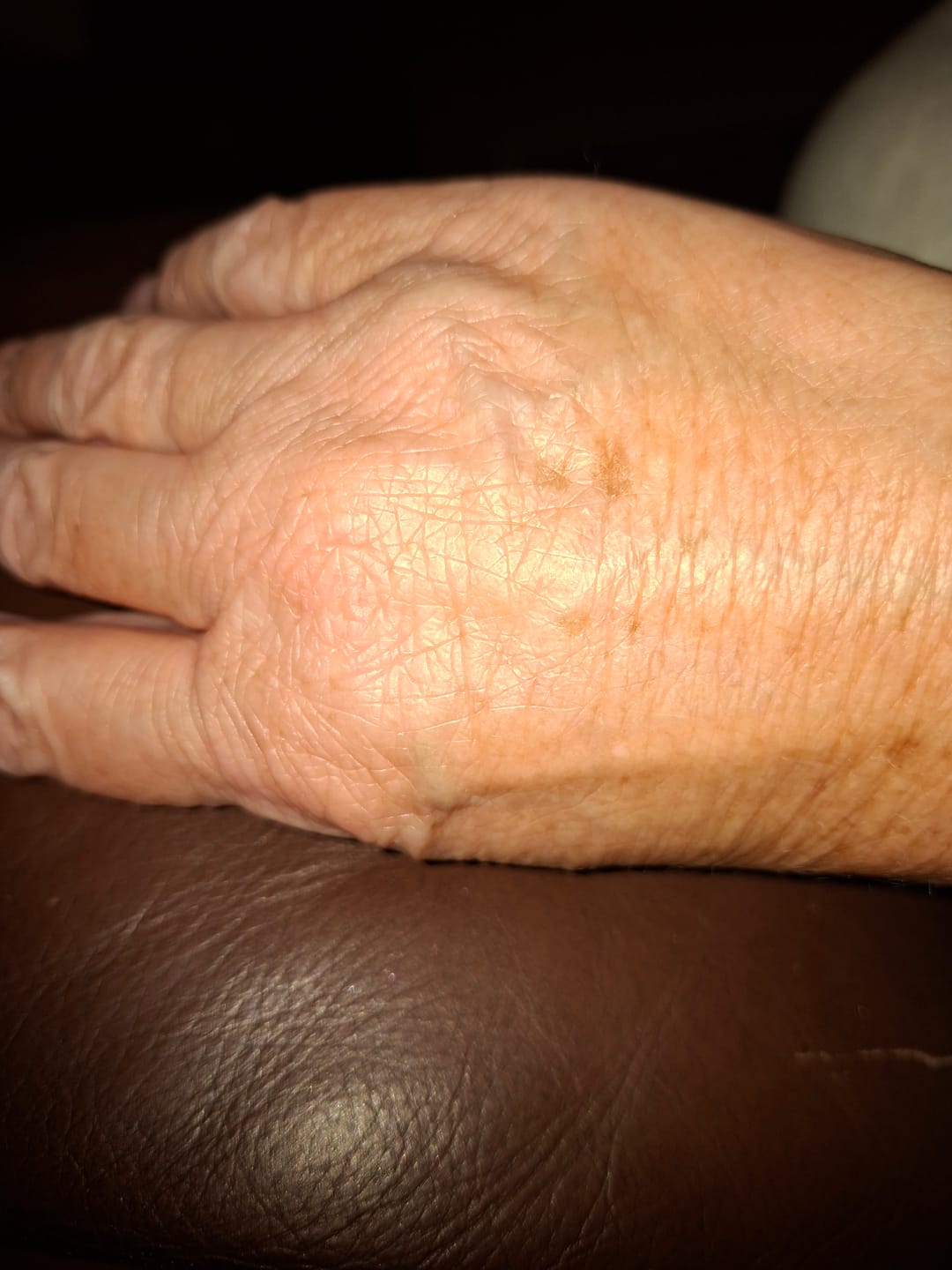 Customer photo review of Grass-Fed Tallow Body Balm | Cold Weather Protection