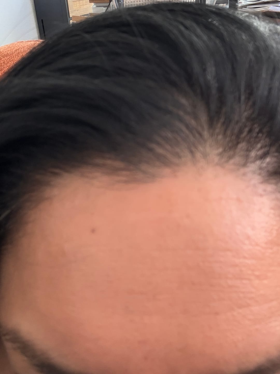 Customer photo review of 1 Month Supply - Deep Collagen Cream