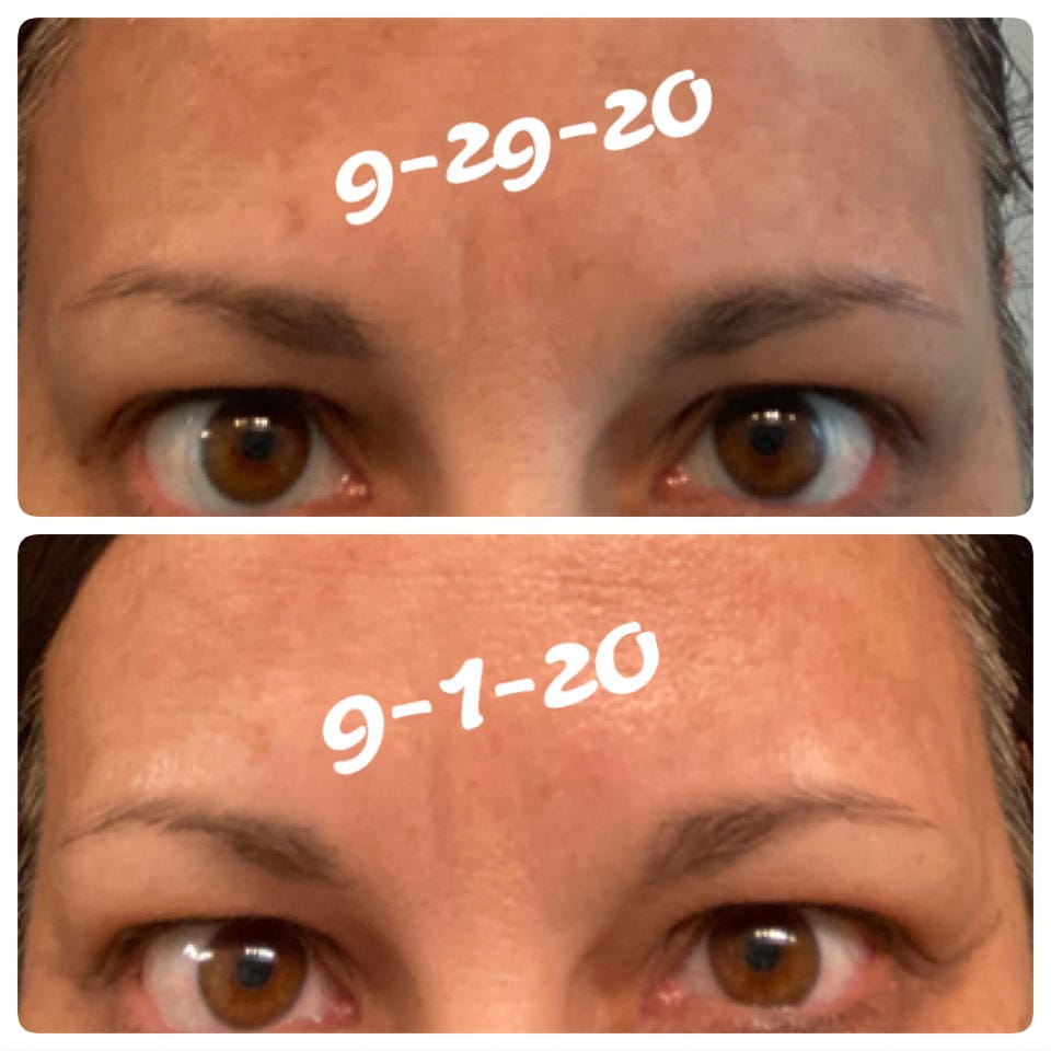 Customer photo review of Kit de Sérum para Pestañas y Cejas