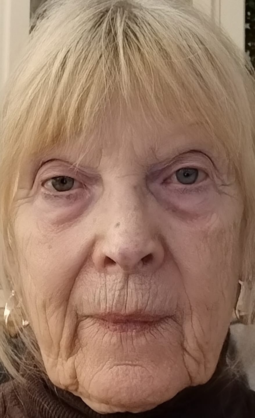Customer photo review of Deep Collagen Cream