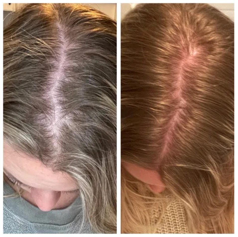 Customer photo review of Spray de Aceite para el Crecimiento del Cabello