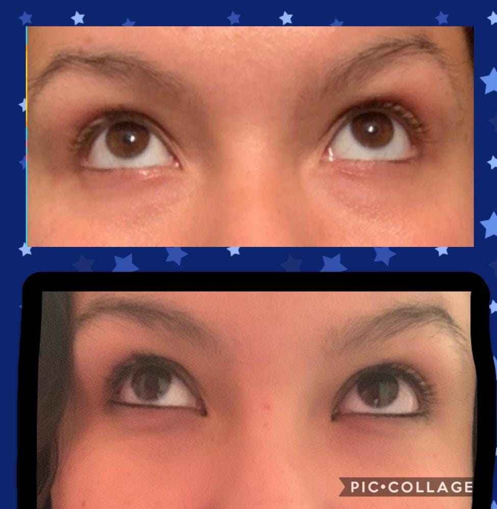 Customer photo review of Kit de Sérum para Pestañas y Cejas