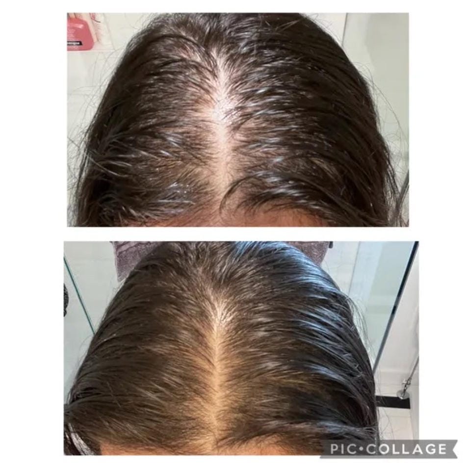 Customer photo review of Spray de Aceite para el Crecimiento del Cabello