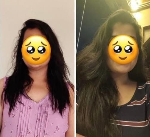 Customer photo review of Ultra Blends Hair Diet | A Nutrient-Rich Treatment for Stronger, Healthier-Looking Hair