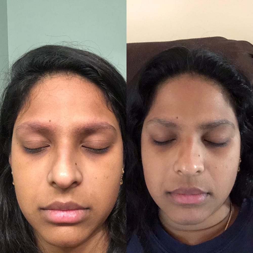 Customer photo review of Kit de Sérum para Pestañas y Cejas