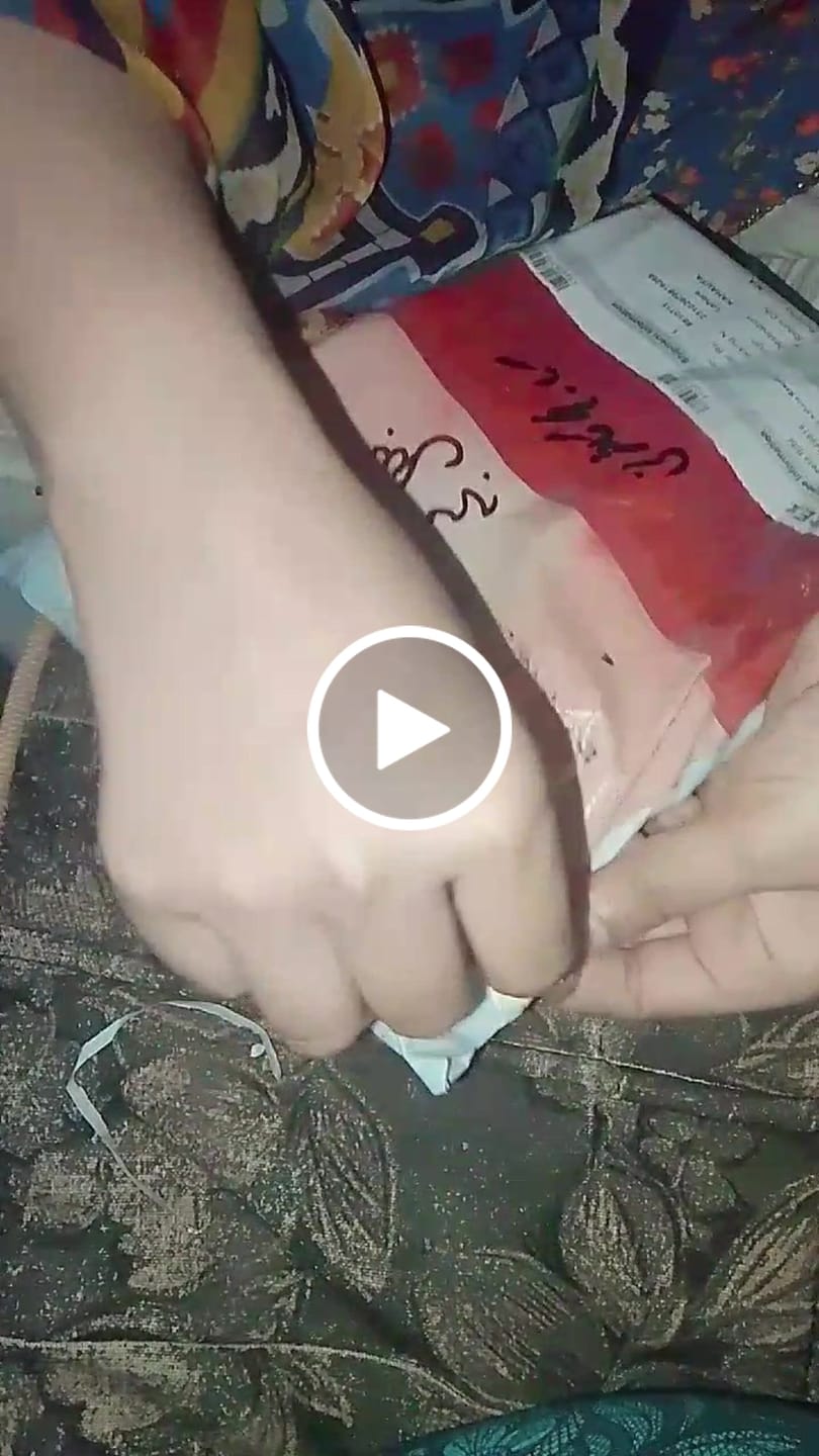 Customer video review of Special Pigmentation Bundle