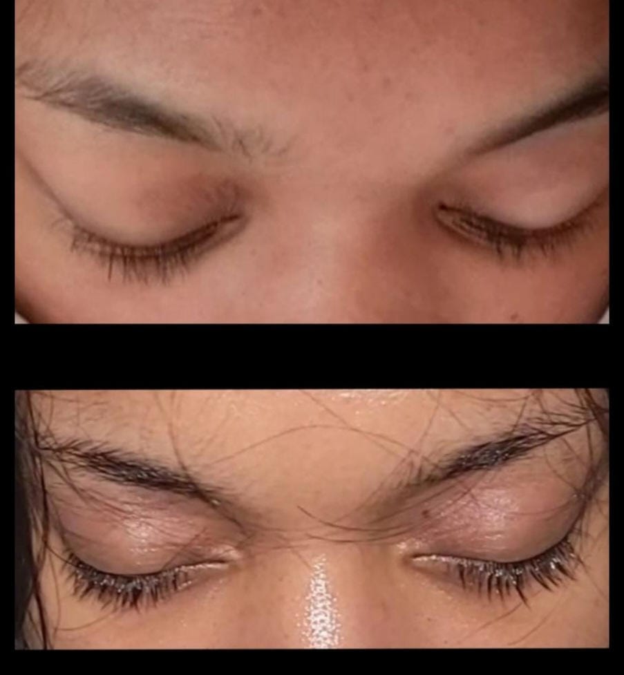 Customer photo review of Spray de Aceite para el Crecimiento del Cabello