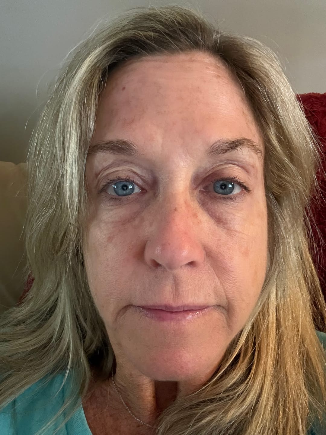 Customer photo review of 6 Month Supply - Deep Collagen Cream