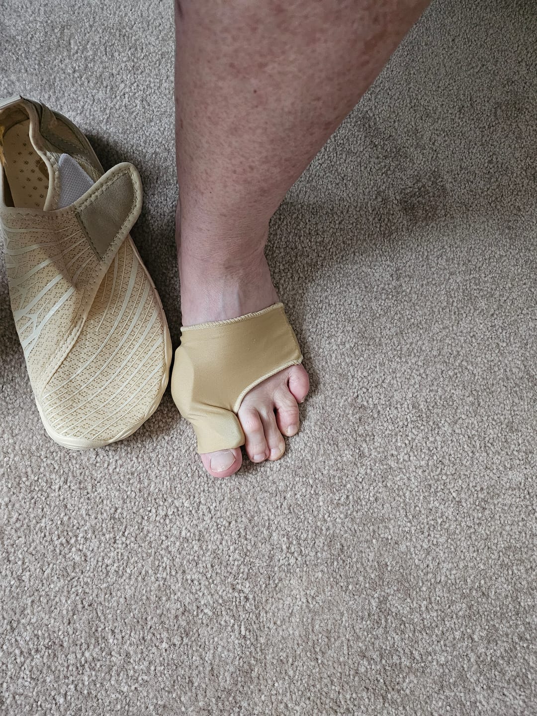 Customer photo review of BareRelief Guard