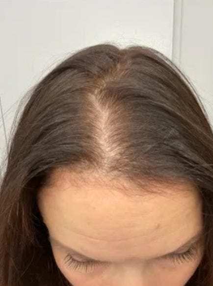 Customer photo review of Spray de Aceite para el Crecimiento del Cabello