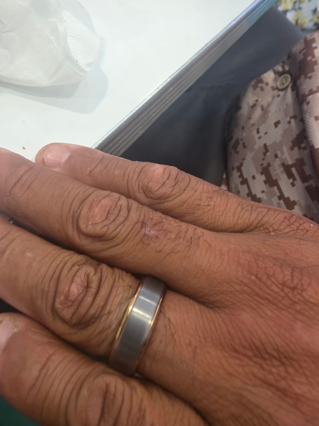 Customer photo review of Ring Exchange