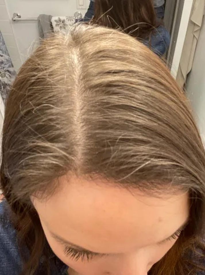 Customer photo review of Spray de Aceite para el Crecimiento del Cabello