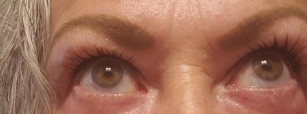 Customer photo review of Kit de Sérum para Pestañas y Cejas