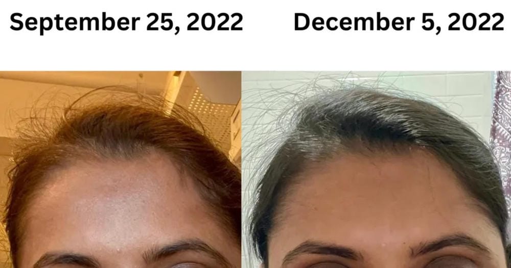 Customer photo review of Spray de Aceite para el Crecimiento del Cabello