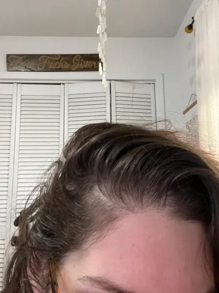 Customer photo review of Spray de Aceite para el Crecimiento del Cabello