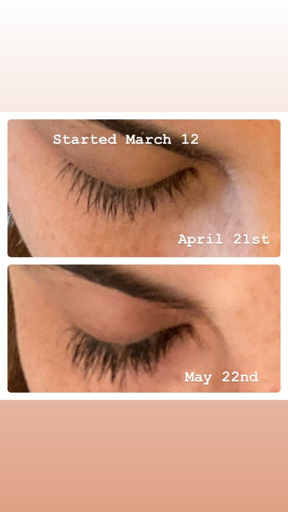 Customer photo review of Máscara de Crecimiento de Pestañas - Mejor que las Postizas