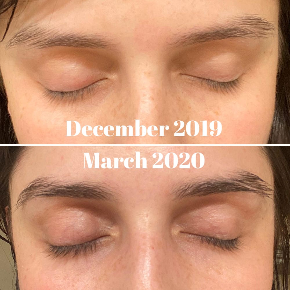 Customer photo review of Máscara de Crecimiento de Pestañas - Mejor que las Postizas