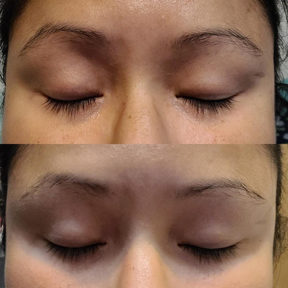 Customer photo review of Kit de Sérum para Pestañas y Cejas