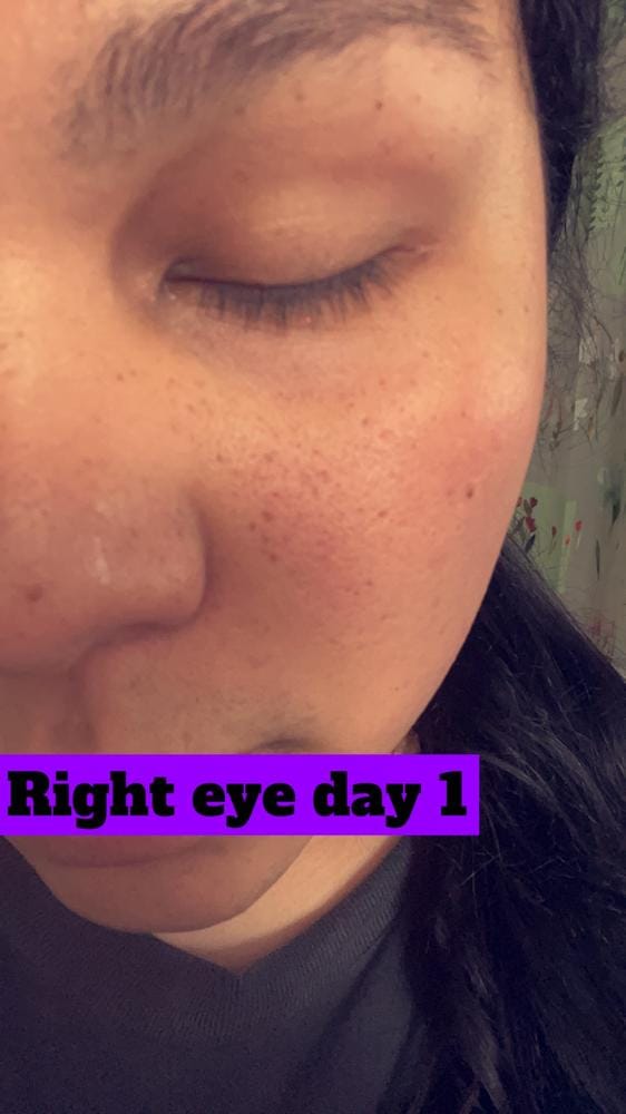 Customer photo review of Spray de Aceite para el Crecimiento del Cabello