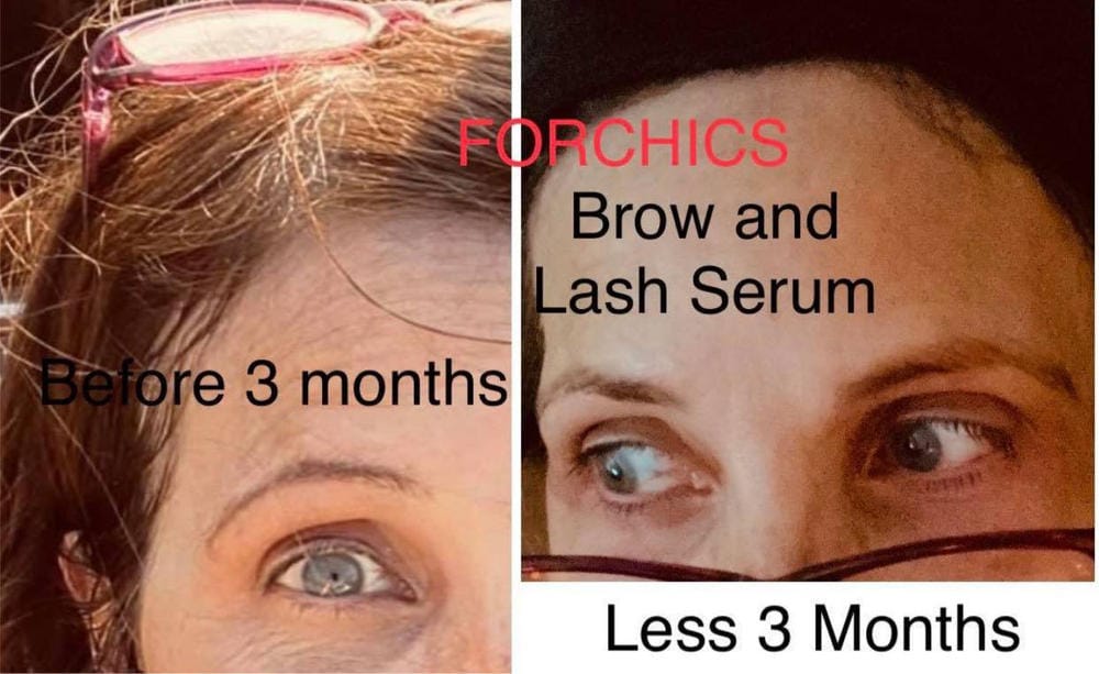 Customer photo review of Kit de Sérum para Pestañas y Cejas
