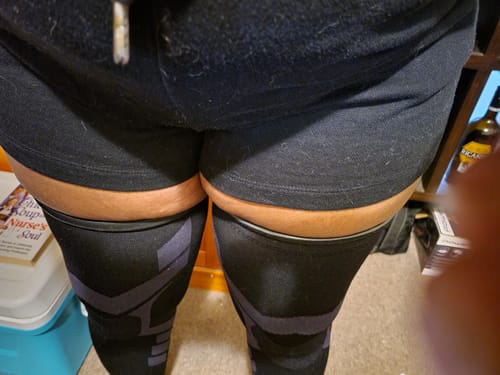 Customer photo review of Compression Sleeves V2 for Knees and Legs