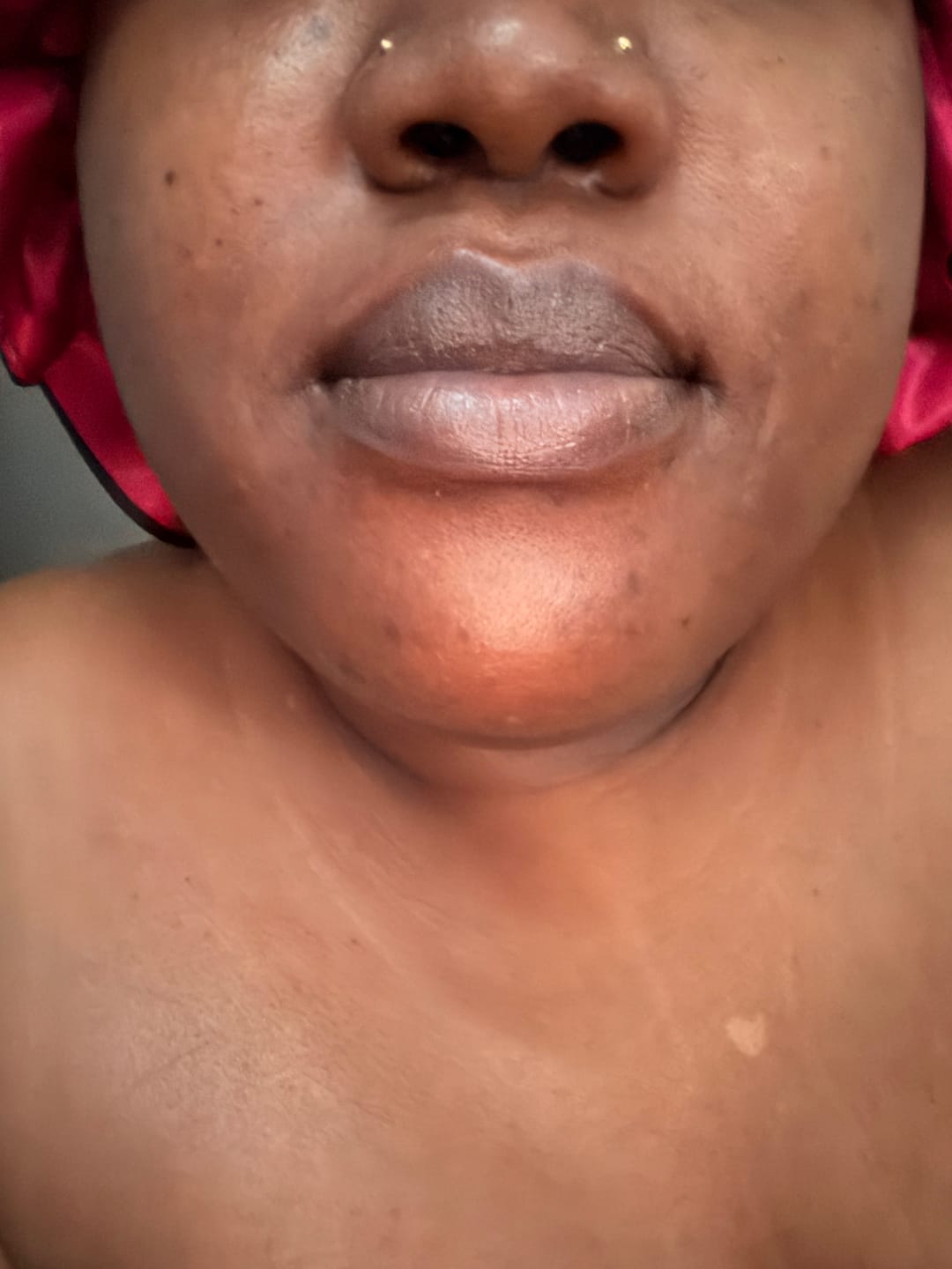 Customer photo review of Turmeric and Lemon Lip Balm (for Dark Lips)