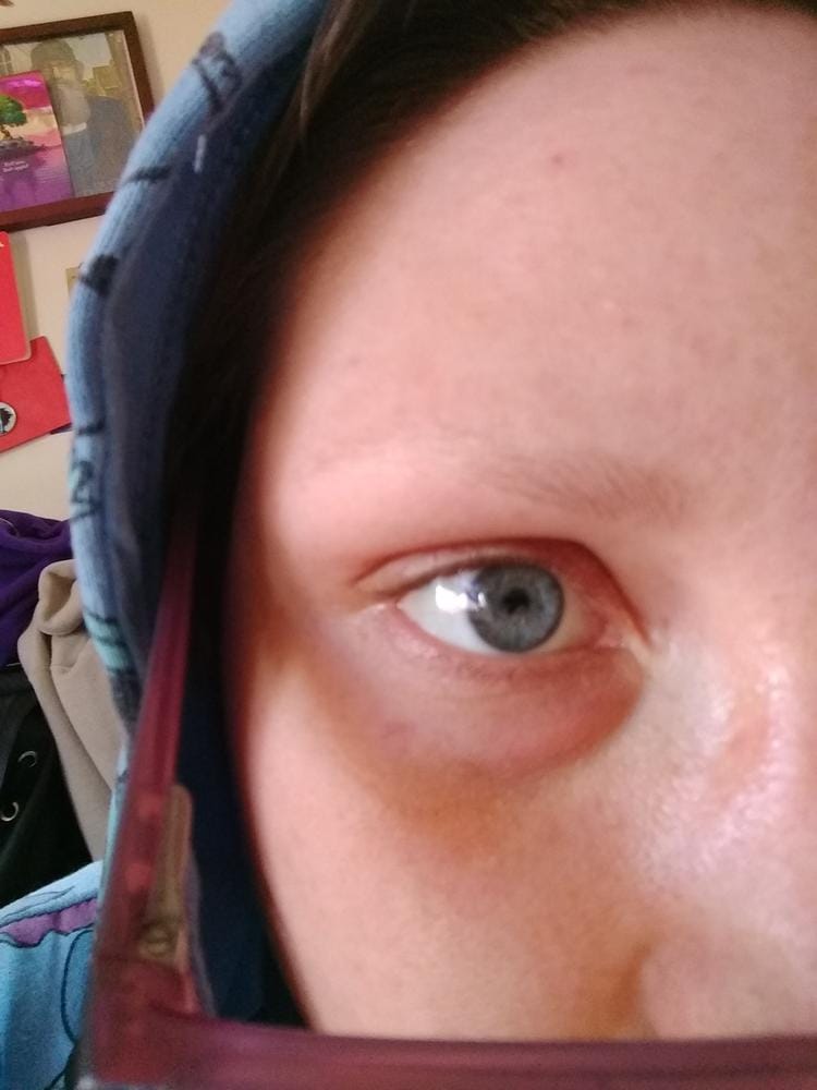 Customer photo review of Máscara de Crecimiento de Pestañas - Mejor que las Postizas