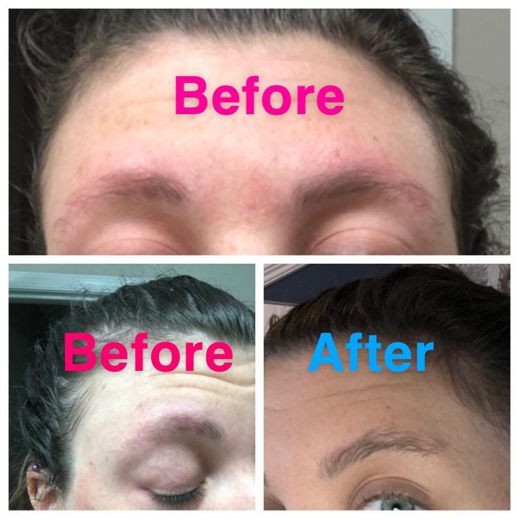 Customer photo review of Kit de Sérum para Pestañas y Cejas