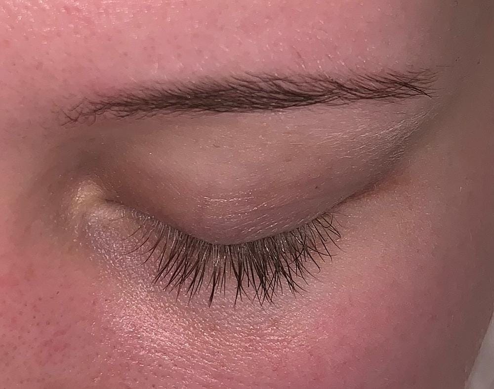 Customer photo review of Máscara de Crecimiento de Pestañas - Mejor que las Postizas