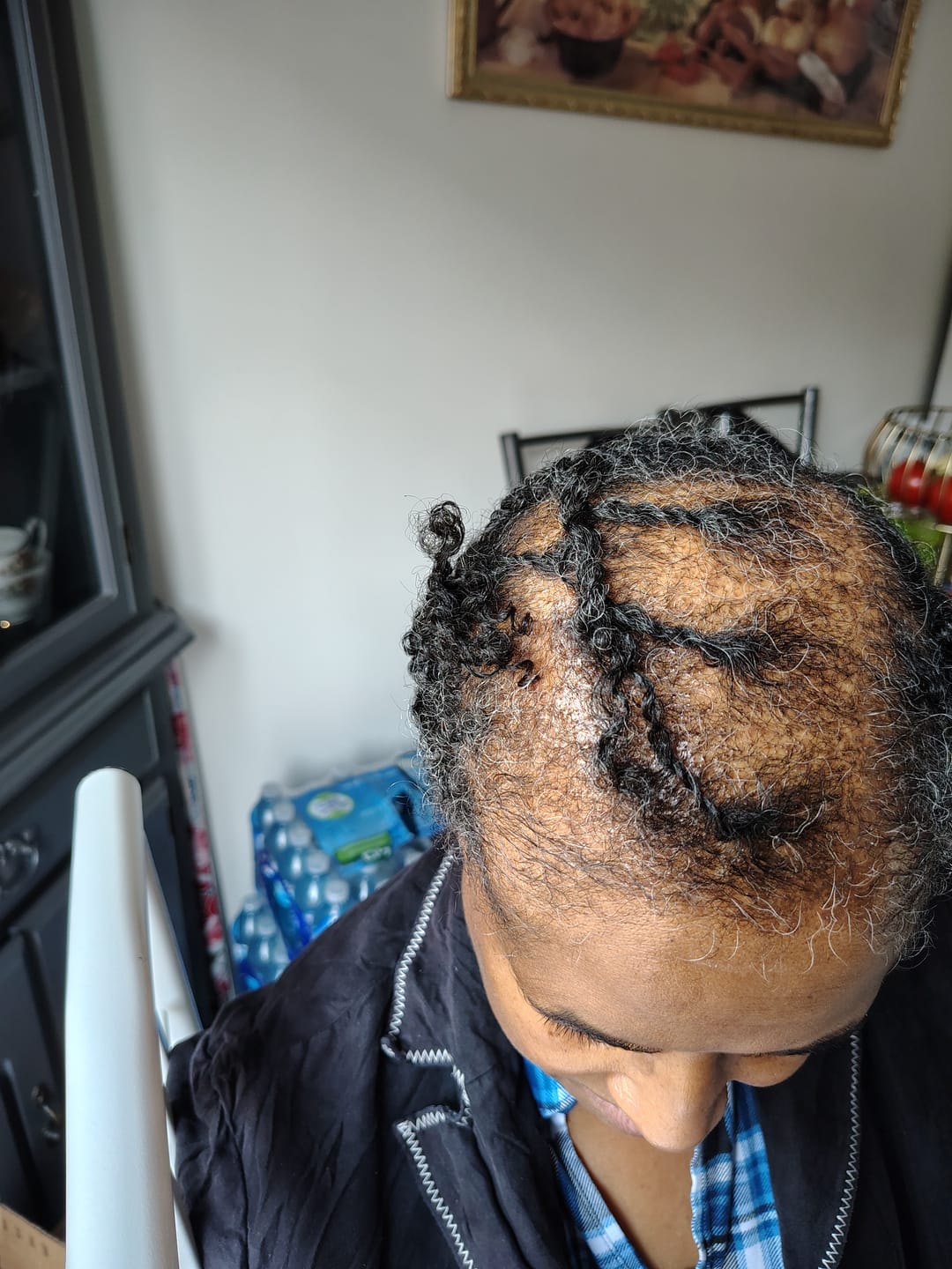 Customer photo review of Healthy Hair Starter Kit- Limited Edition