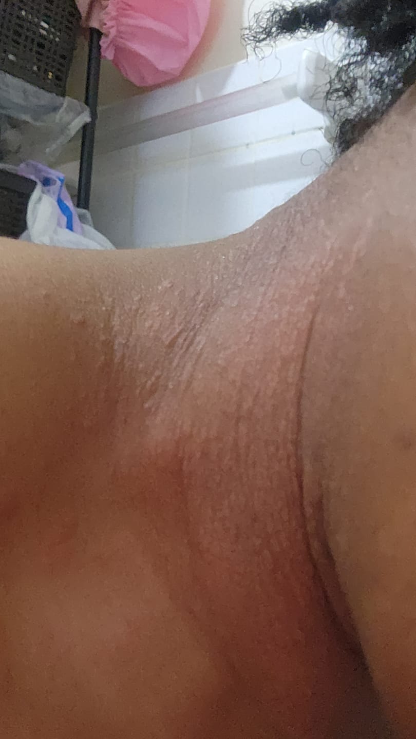 Customer photo review of NEW Facial Day Cream with SPF 30